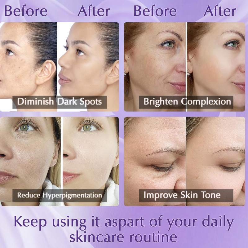 Dark Spot Remover for Face, Dark Spot Corrector Cream, Rapid Tone Repair Upgraded Formula Retinol Serum for Sun Spots, Age Spots, Skin Brown, Melasma Skin Care with Vitamin C for Women 1.7 Fl OZ