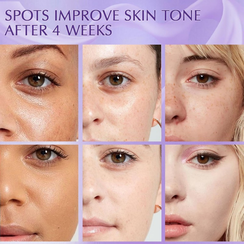 Dark Spot Remover for Face, Dark Spot Corrector Cream, Rapid Tone Repair Upgraded Formula Retinol Serum for Sun Spots, Age Spots, Skin Brown, Melasma Skin Care with Vitamin C for Women 1.7 Fl OZ